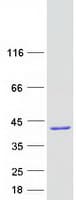 Human NUDT22 Protein (Recombinant Myc-DDK (Flag))