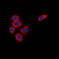 Polyclonal Rabbit anti-Human DOK1 Antibody (Internal, IHC, IF, WB)