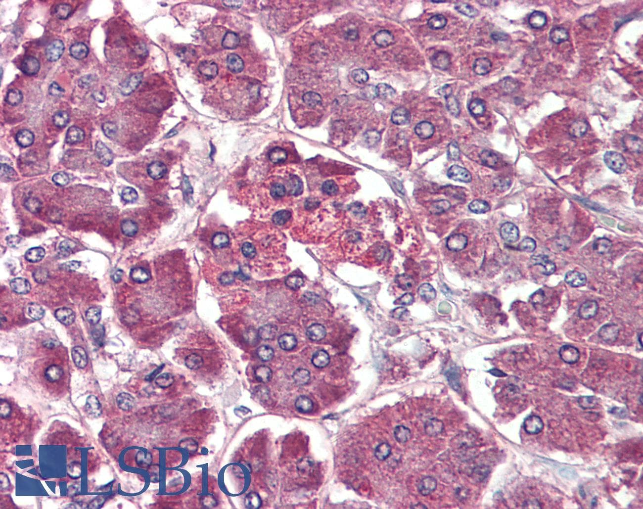 IHC-plus™ Polyclonal Goat anti-Human CCR4 Antibody (Extracellular Domain, IHC, WB)