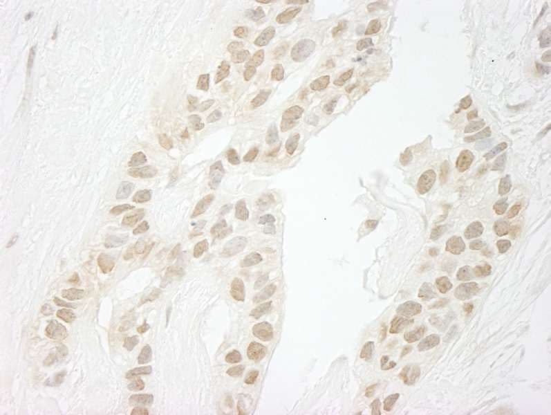 Polyclonal Rabbit anti-Human PPP1CC / PP1 Gamma Antibody (aa280-C-term, IHC)
