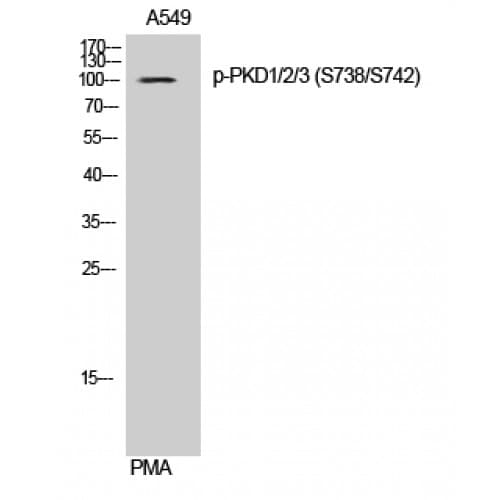 PKD1/2/3 / PKC Mu Antibody (680-760 aa)