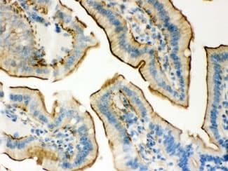 PLEC / Plectin Antibody