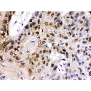 TCF7L1 / TCF-3 Antibody (aa561-588)