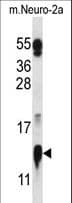 COX5A Antibody (aa27-55)