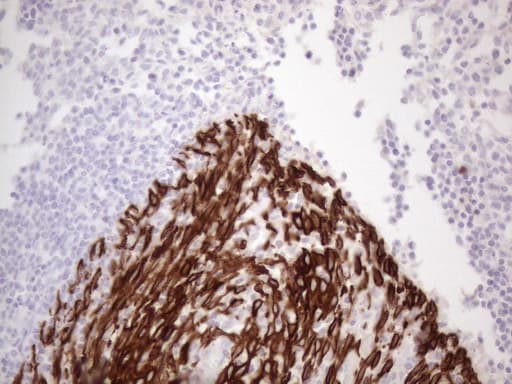 KRT16 / CK16 / Cytokeratin 16 Antibody (clone OTI2H8)