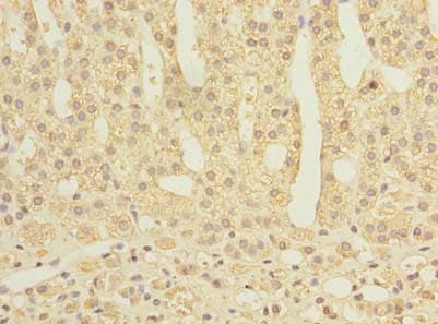 PROSC Antibody