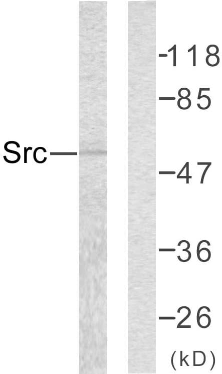 Polyclonal Rabbit anti-Human SRC Antibody (aa386-435, WB)