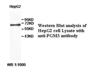 Polyclonal Rabbit anti-Human PGM3 Antibody (aa61-318, IHC, WB)