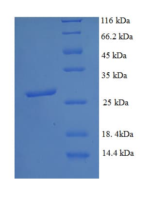 Human DNMT3A Protein (Recombinant His)