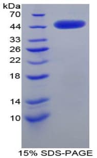 Rat CRH / CRF Protein (Recombinant His-GST)