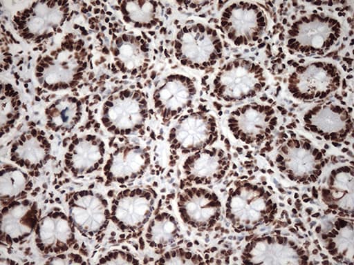 TRIM28 / KAP1 Antibody (clone OTI9F4, Carrier-free)