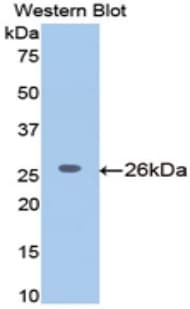 Beta-N-Acetylglucosaminidase Antibody (aa19-222)