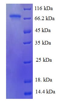 Human ATF2 Protein (Recombinant His-SUMO)