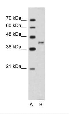 BDKRB2/Bradykinin B2 Receptor Antibody (N-Terminus)