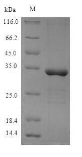 Mouse METRNL Protein (Recombinant 6His, N-terminus)