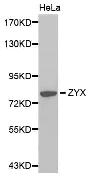 Polyclonal Rabbit anti-Human Zyxin Antibody (IHC, WB)