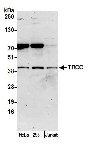TBCC Antibody (aa1-50)