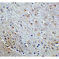 APP / Beta Amyloid Precursor Antibody