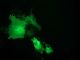 SH2B3 / LNK Antibody (clone OTI1F6)