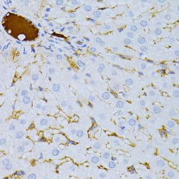 TAPBP / Tapasin Antibody