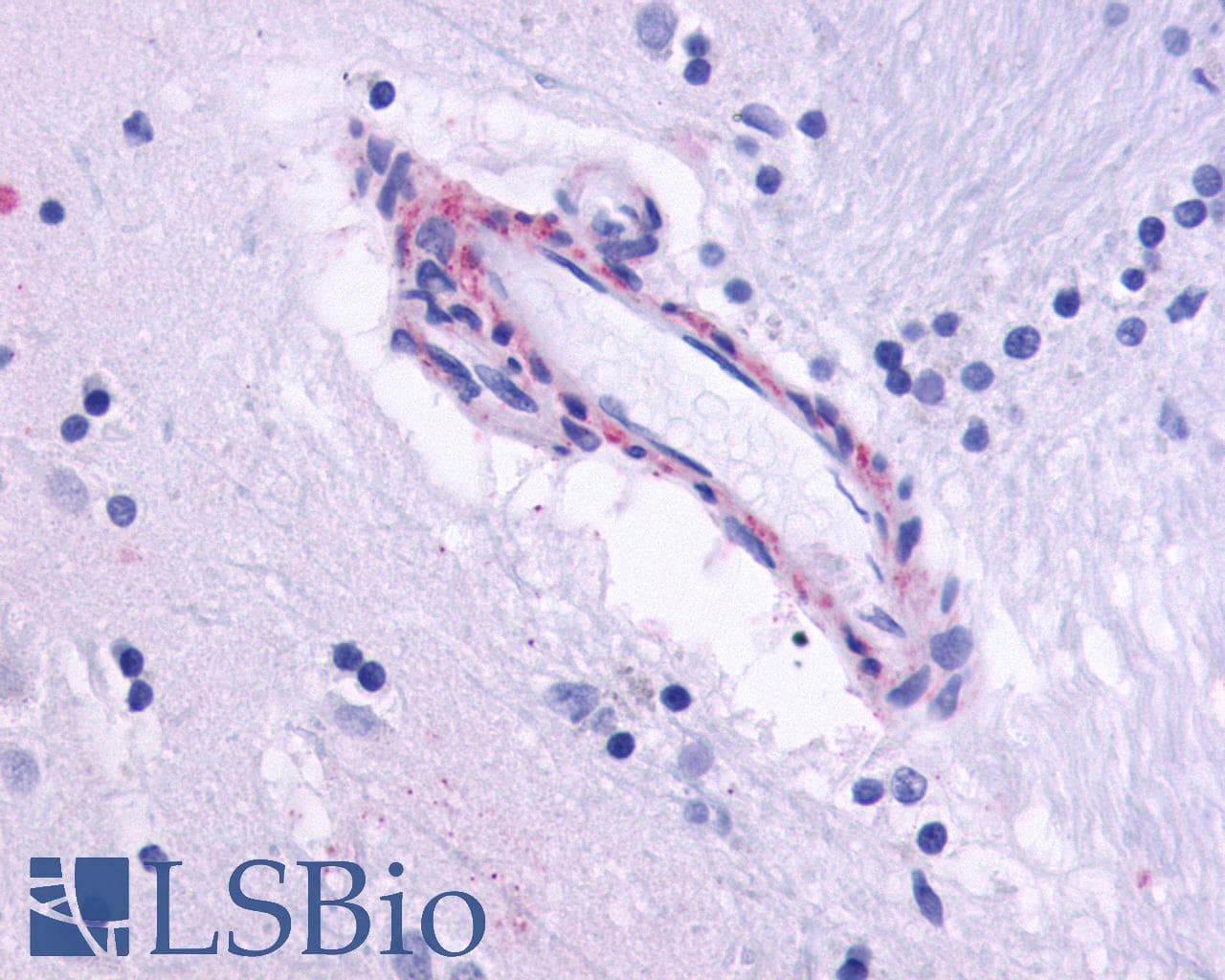 PathPlus™ CHRM5 / M5 Antibody (Cytoplasmic Domain)