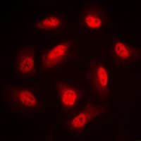LIMK1 + LIMK2 Antibody (phospho-Thr508/Thr505)