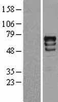 RPS6KB1 / P70S6K / S6K Protein (Over-Expression Lysate Myc-DDK (Flag))