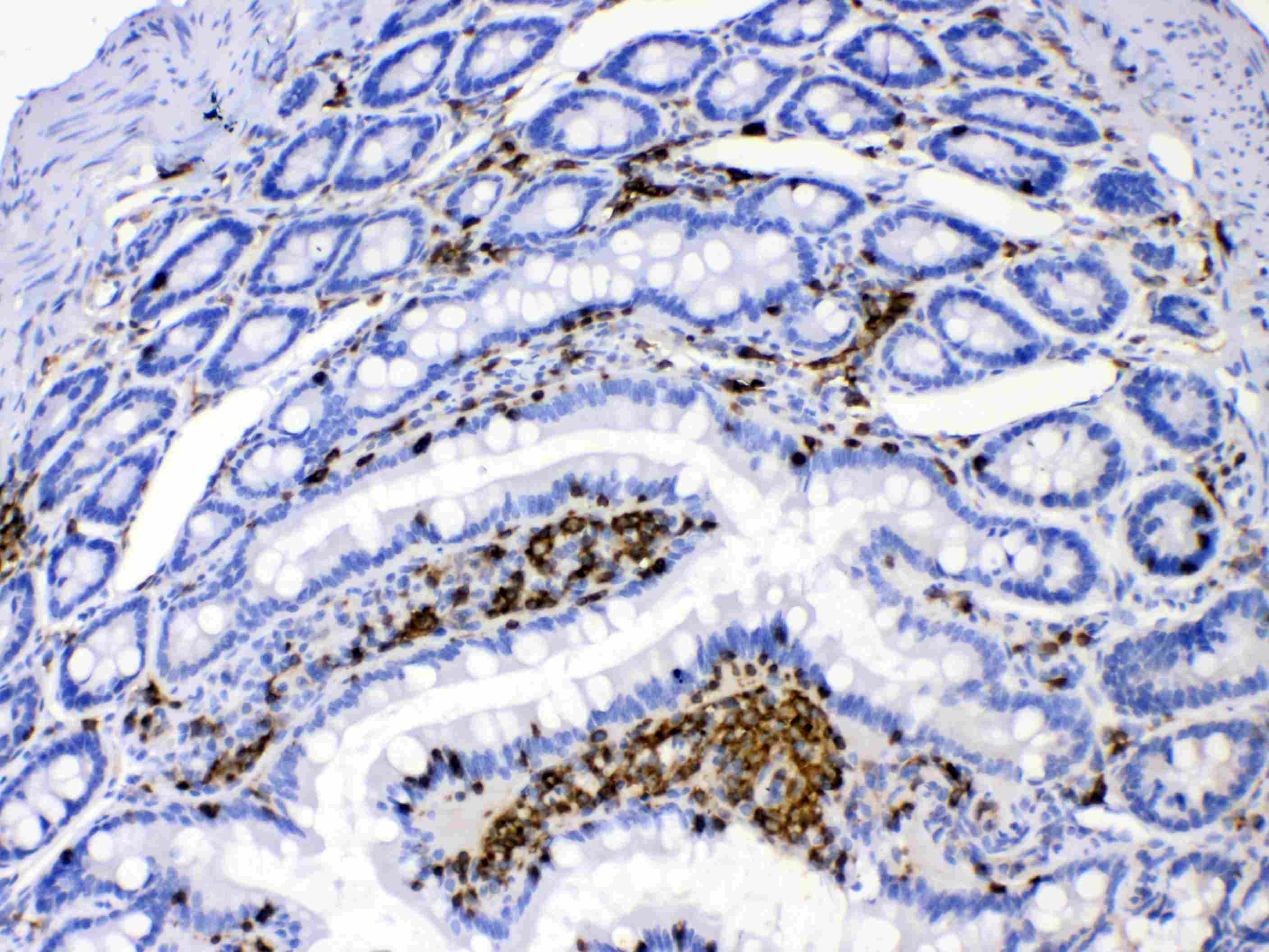 DHODH Antibody