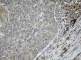 Monoclonal Mouse anti-Human F13A1 / Factor XIIIa Antibody (clone OTI3G12, IHC, WB)