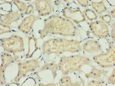 ACBD4 Antibody (aa1-305)
