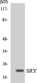 SRY Antibody (aa31-80)