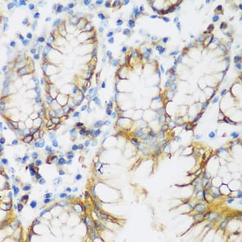 CDH1 / E Cadherin Antibody