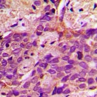 ACSS1 Antibody (C-Terminus)