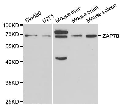 ZAP70 Antibody