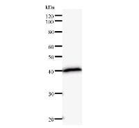 SATB2 Antibody (clone SATBA4B10)