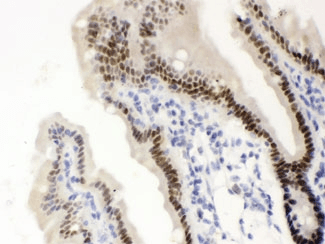 Vitamin D Receptor / VDR Antibody