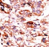 Polyclonal Rabbit anti-Human ADCK5 Antibody (aa434-464, IHC, WB)