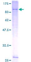 Human KCNK5 / TASK2 Protein (Recombinant GST)