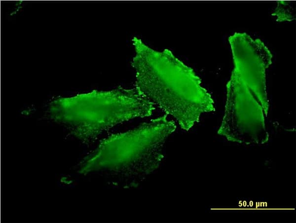 MARS Antibody (clone 5G5)