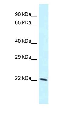 Polyclonal Rabbit anti-Mouse LAPTM4B Antibody (C-Terminus, WB)
