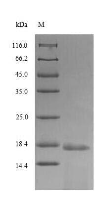 Human H2AFX / H2AX Protein (Recombinant 6His, N-terminus)