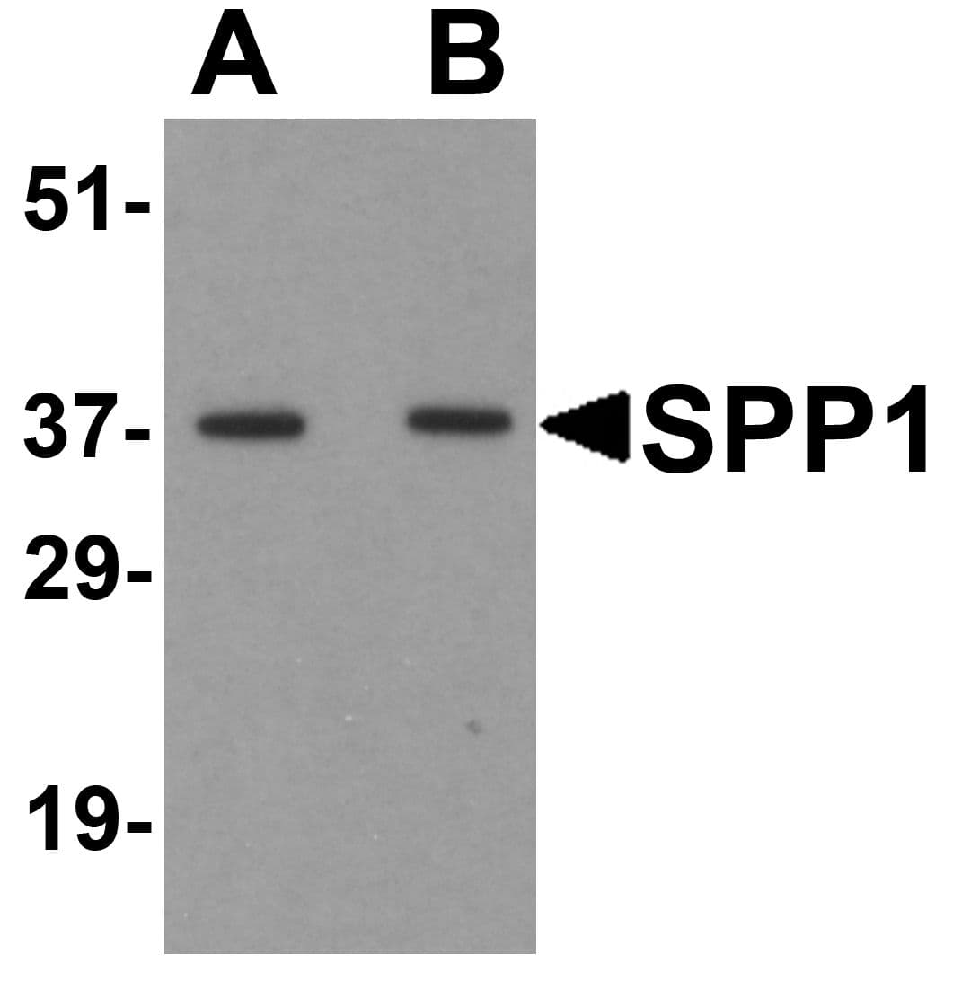 PathPlus™ SPP1 / Osteopontin Antibody