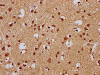 FEV / PET1 Antibody