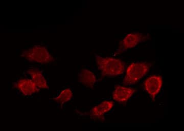 ATF2 Antibody (phospho-Ser112,pSer94)