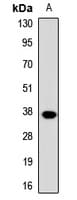 DOK4 Antibody