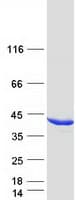 Human AKR1C4 / Chlordecone Reductase Protein (Recombinant Myc-DDK (Flag))