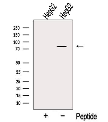 Polyclonal Rabbit anti-Human OSBPL10 Antibody (WB)