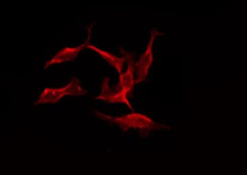 KLRC1 / NKG2A / CD159a Antibody