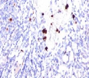 CSF3 / G-CSF Antibody (clone PRPN2-1)