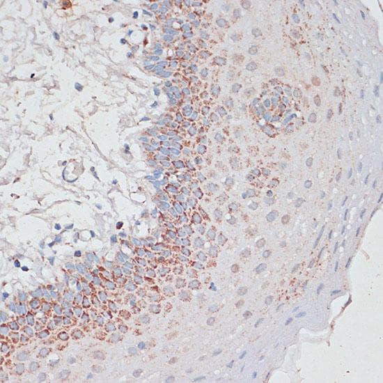 DSP / Desmoplakin Antibody